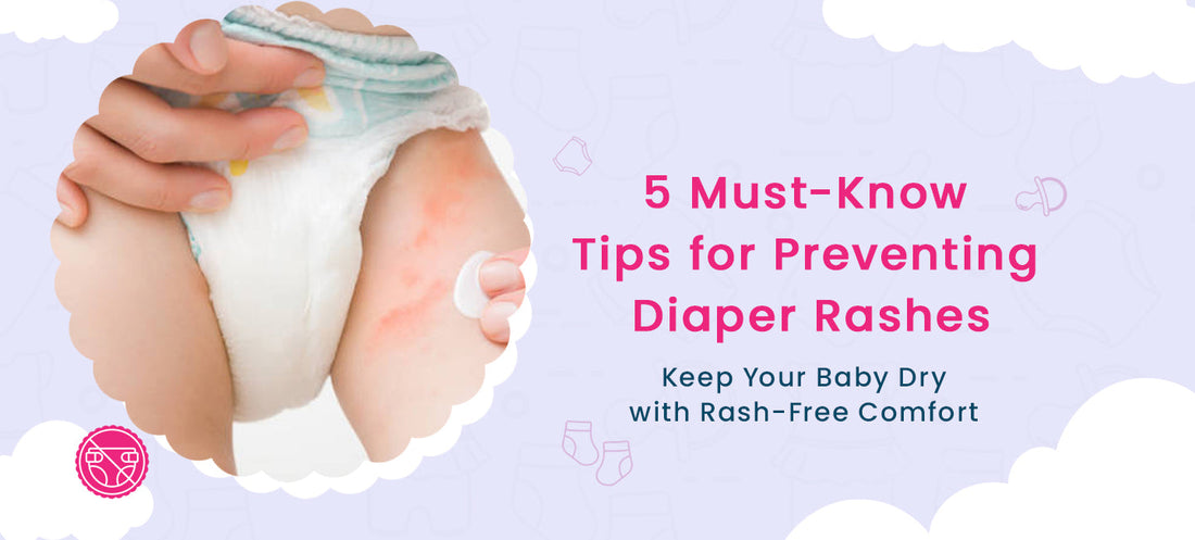 5 Must-Know Tips for Preventing Diaper Rashes | KiddySoft Baby Care